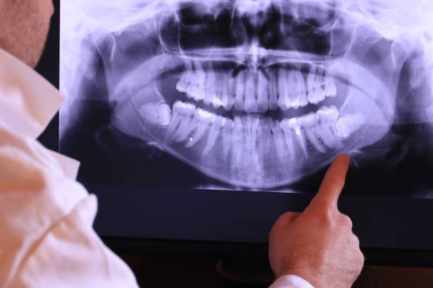 Best Root Canal Emergency Dentist  in Rio Verde, AZ