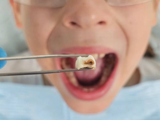 Best Broken Tooth Emergency  in Rio Verde, AZ